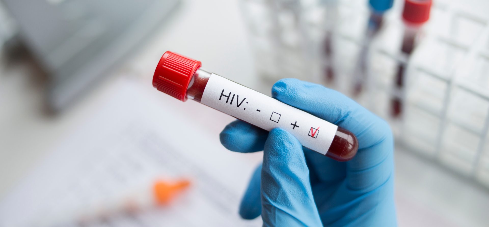 O femeie s ar fi vindecat în premieră de HIV folosind un tratament nou